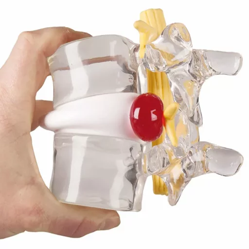 Skiveprolaps simulator 2x forstørrelse 4400