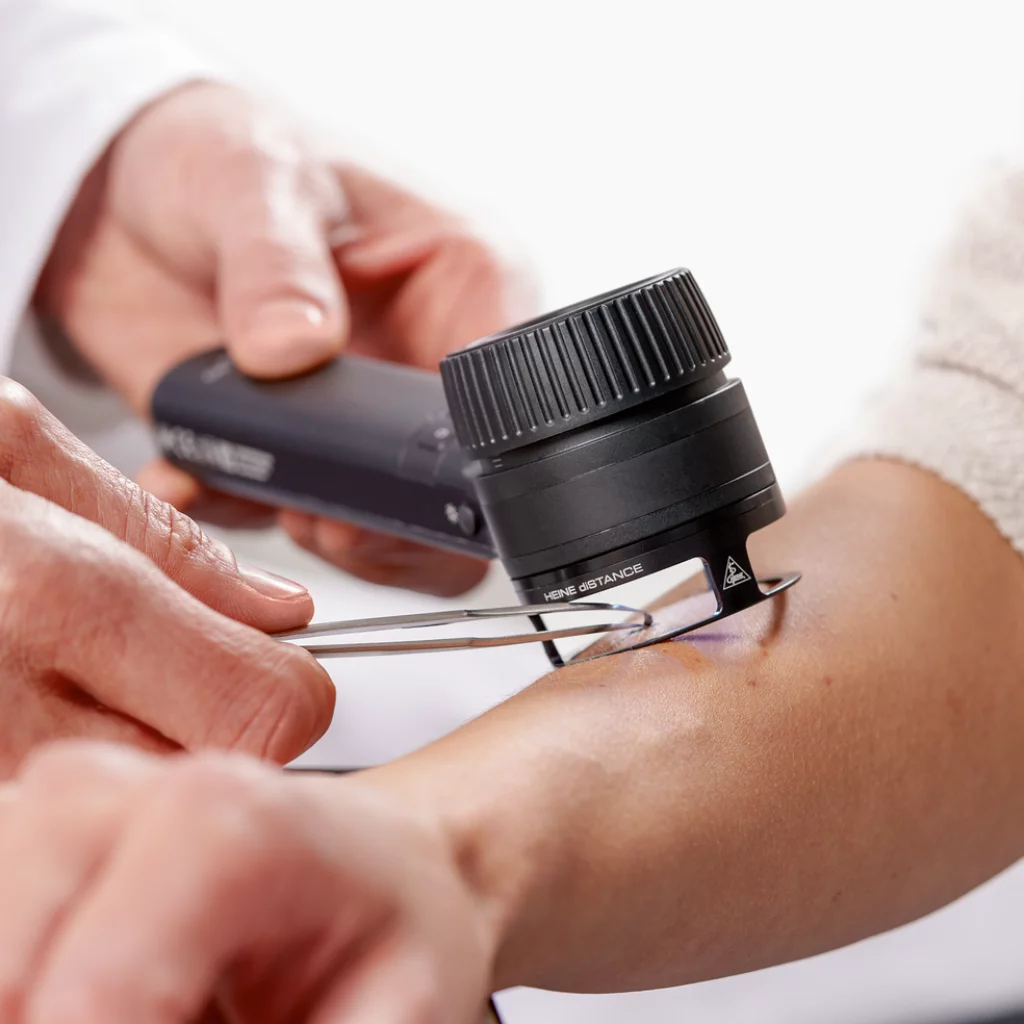 HEINE diSTANCE for HEINE DELTA 30/-PRO K-000.34.103