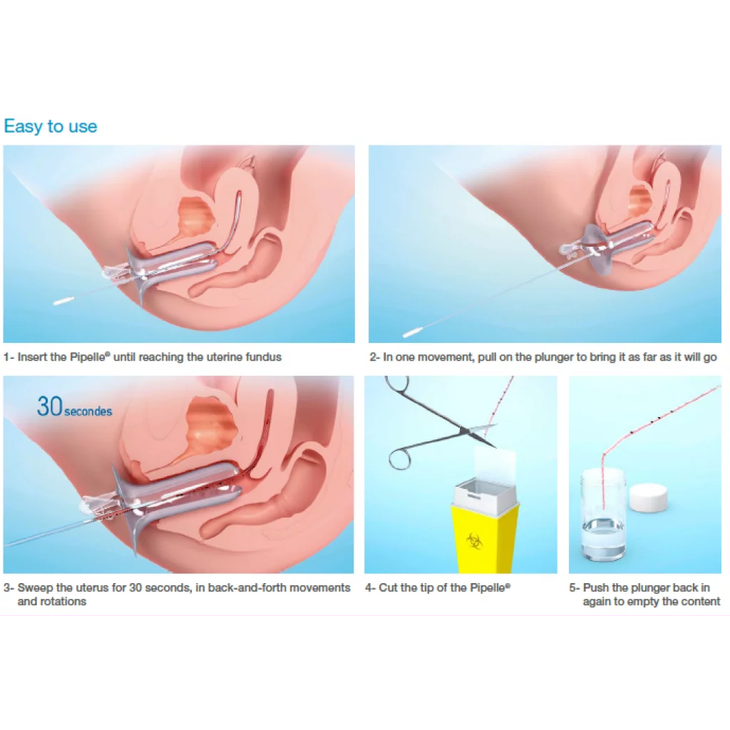 PIPELLE DE CORNIER sterile