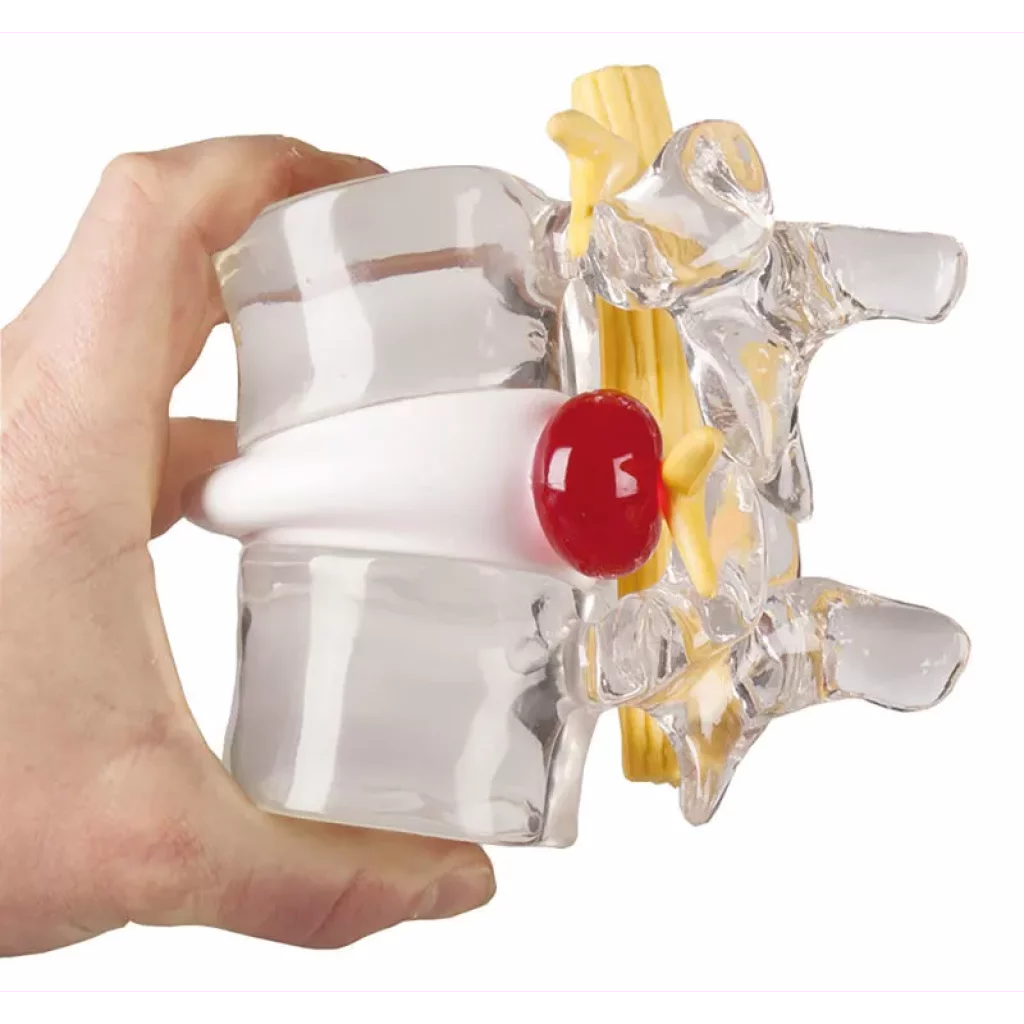 Skiveprolaps simulator 2x forstørrelse 4400