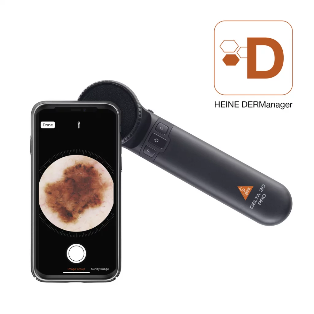 DERMATOSKOP HEINE DELTA 30 PRO sett K-236.28.306