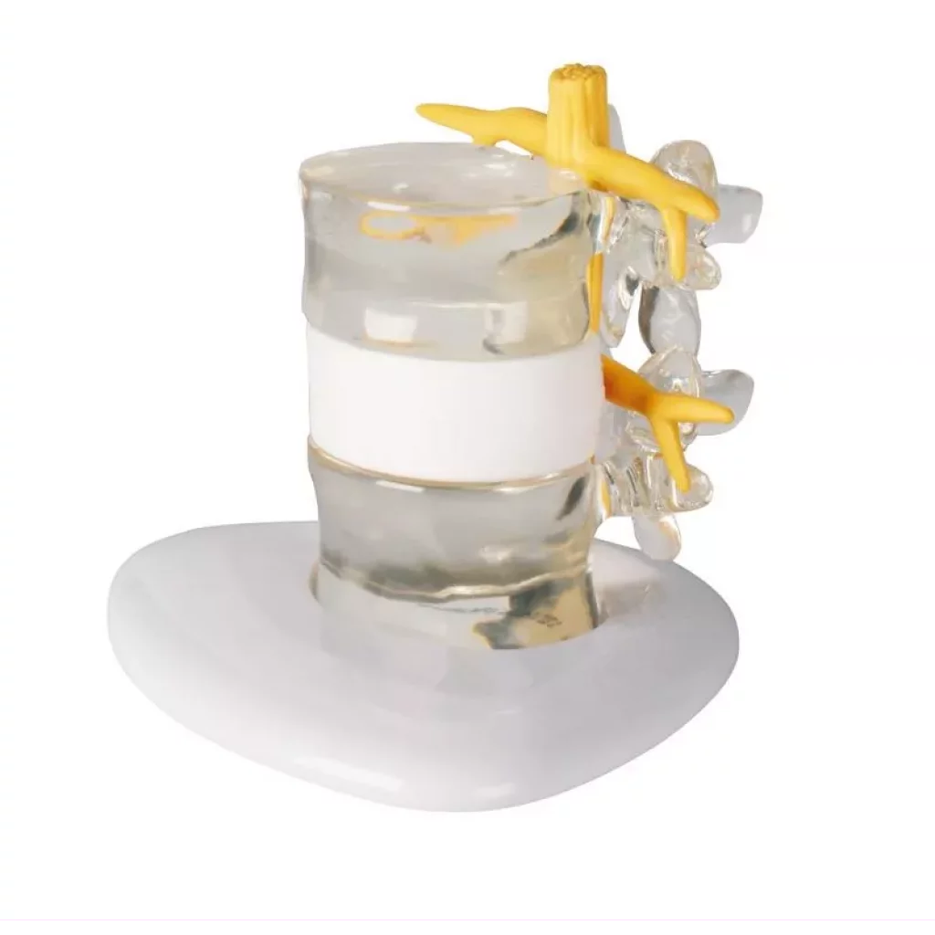 Skiveprolaps simulator 2x forstørrelse 4400