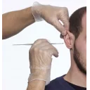 cerumenskje-proscoop-orevoksfjerner