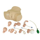 gynekologisk-undersokelsesmodell-lm110-erstatter-lm50